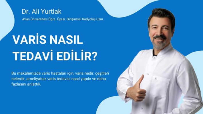 ameliyatsız varis tedavisi