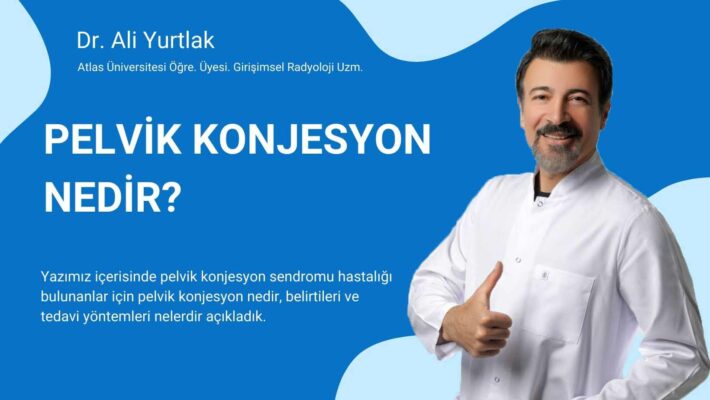 pelvik konjesyon sendromu