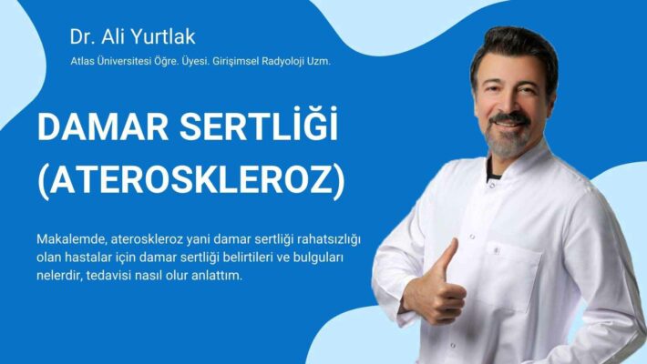ameliyatsız damar sertliği tedavisi