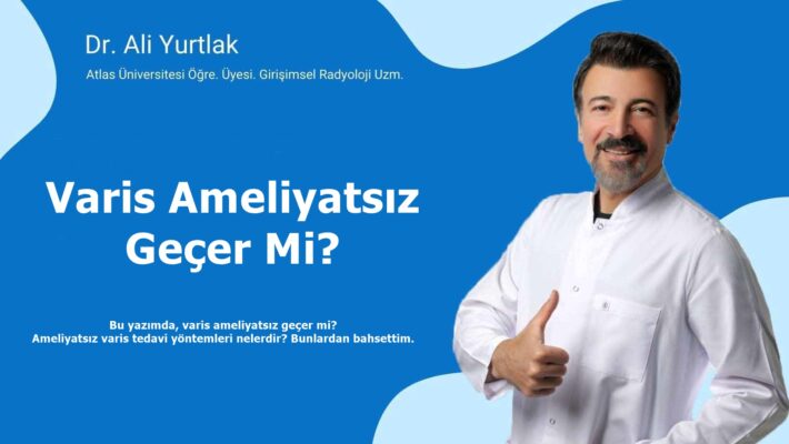 varis ameliyatsız geçer mi